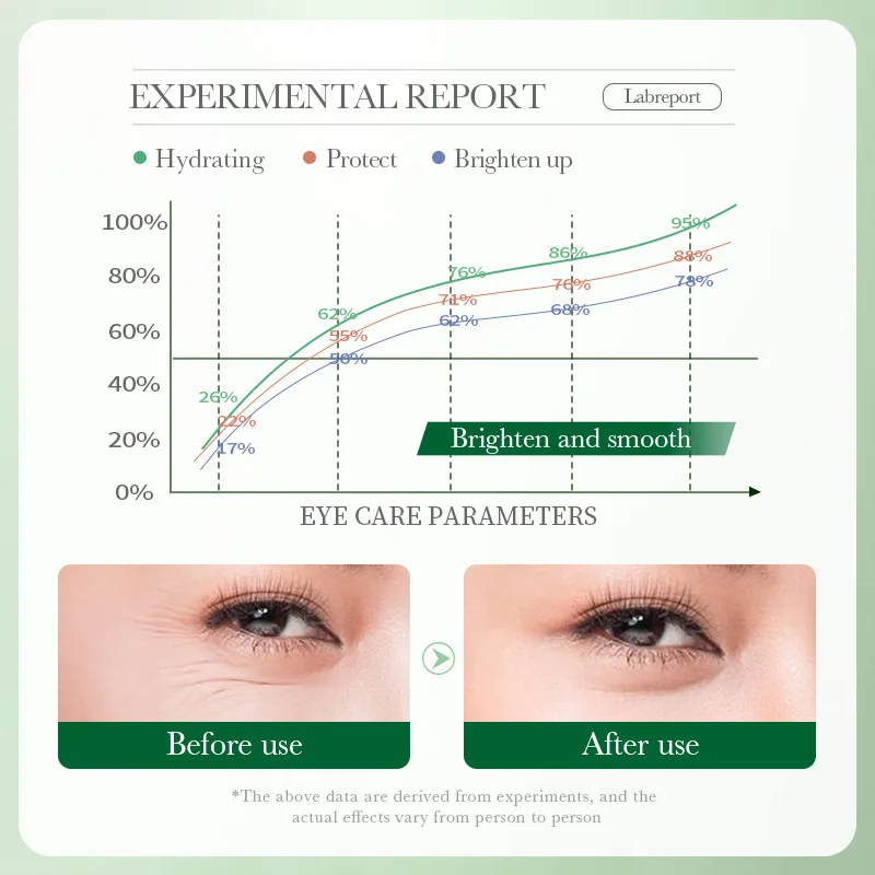 Centella Asiatica Eye Cream Mo - Beauty Huda Makeup review and price