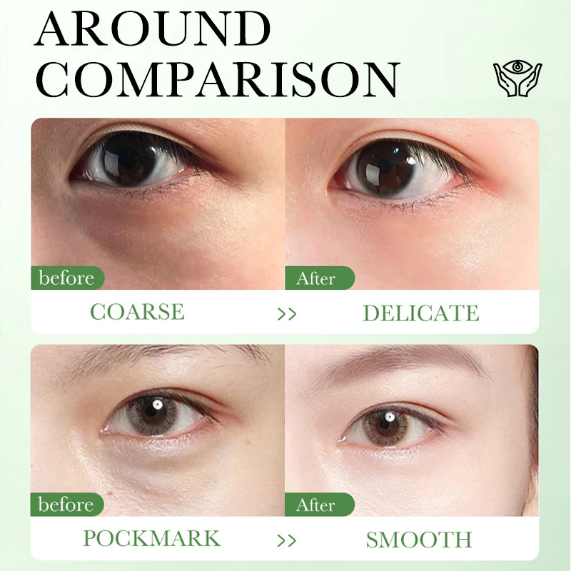 Centella Asiatica Eye Cream Mo - Beauty Huda Makeup review and price